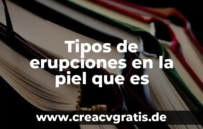 Qué es y para qué sirve Mecanet 8 Tipos de erupciones en la piel que es
